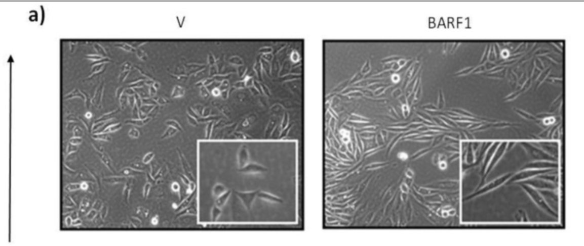 Células de cáncer cervical SiHa transfectadas con vector control (V) o BARF1. El estudio describe una morfología fusiforme en las células que expresan BARF1, en el contexto de la transición epitelio-mesénquima.